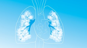 Lungs to be used  solely wíth INOmax campaign